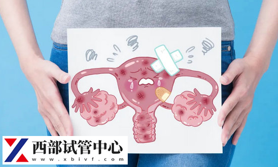 子宮內膜異位癥是一種婦科疾病