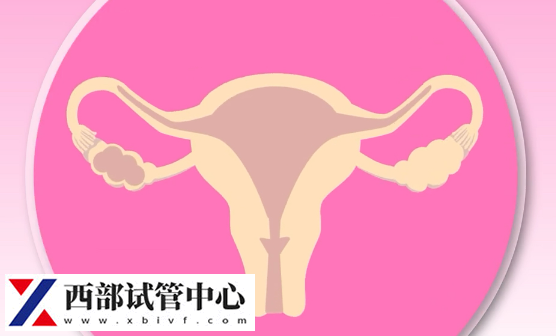 1期子宮內膜異位癥患者通常無明顯癥狀